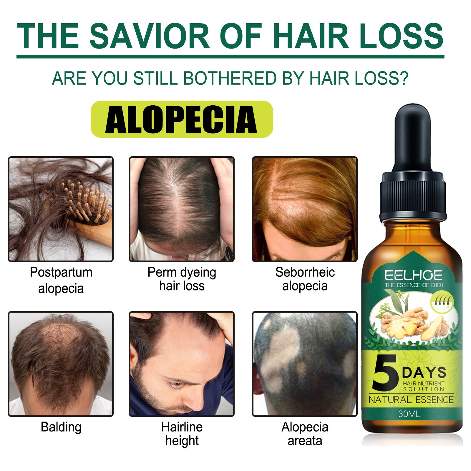 Eelhoe Ginger Hair Essential Oil. Eelhoe Ginger Hair Essential Oil by DC-THE CEO