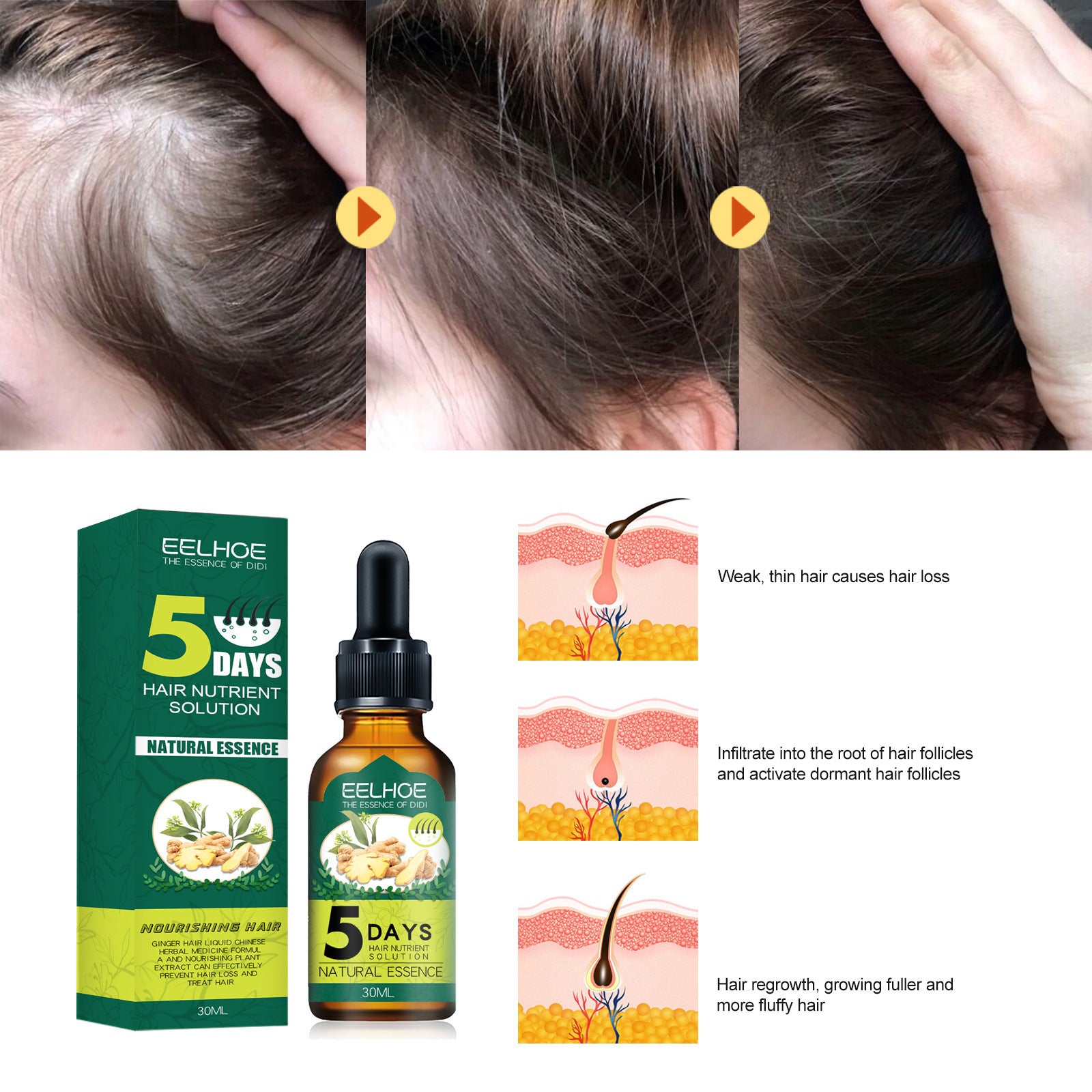 Eelhoe Ginger Hair Essential Oil. Eelhoe Ginger Hair Essential Oil by DC-THE CEO