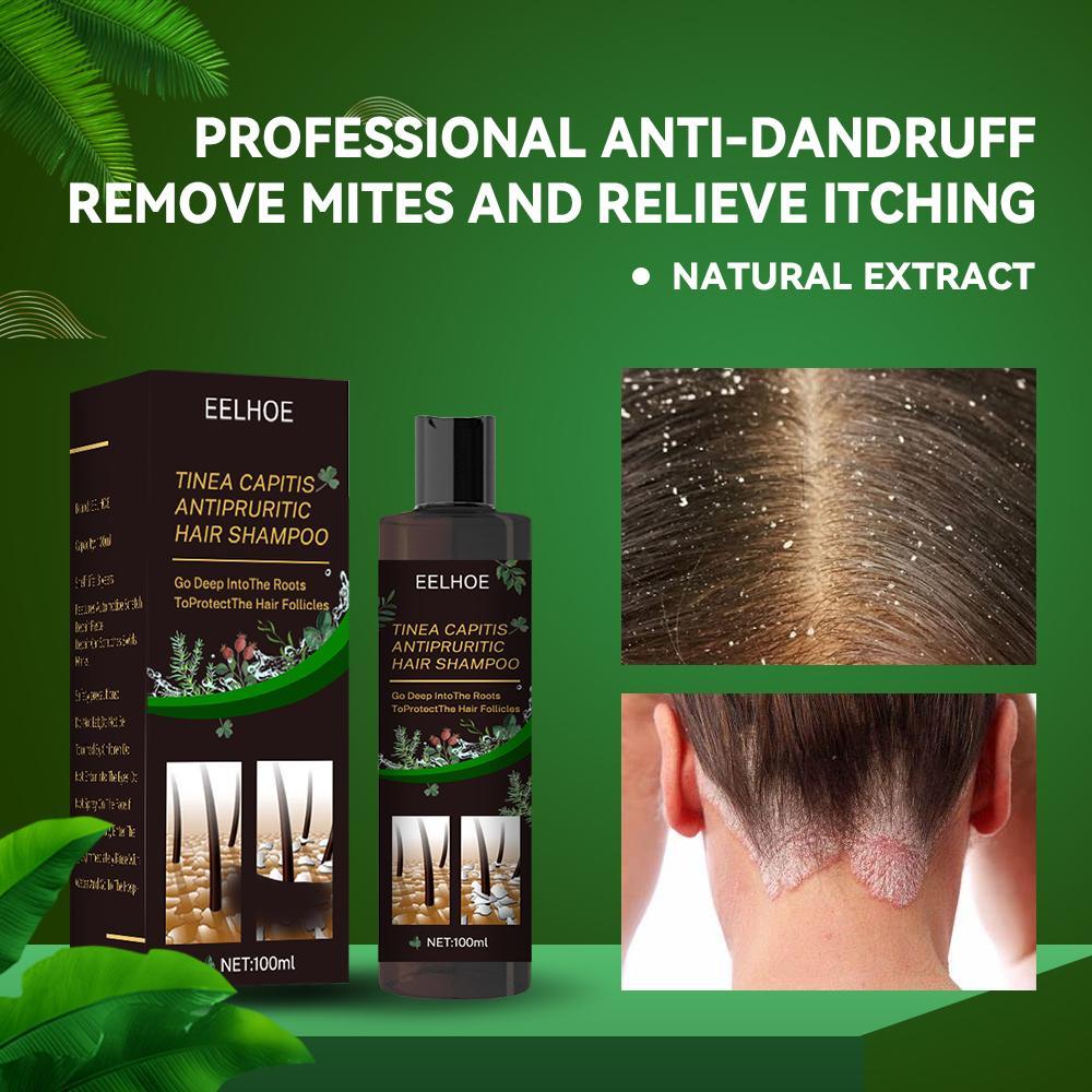 EELHOE Anti-Dandruff Shampoo - Itch Relief, Hair Loss Prevention, Oil Control & Refreshing Care by DC-THE CEO
