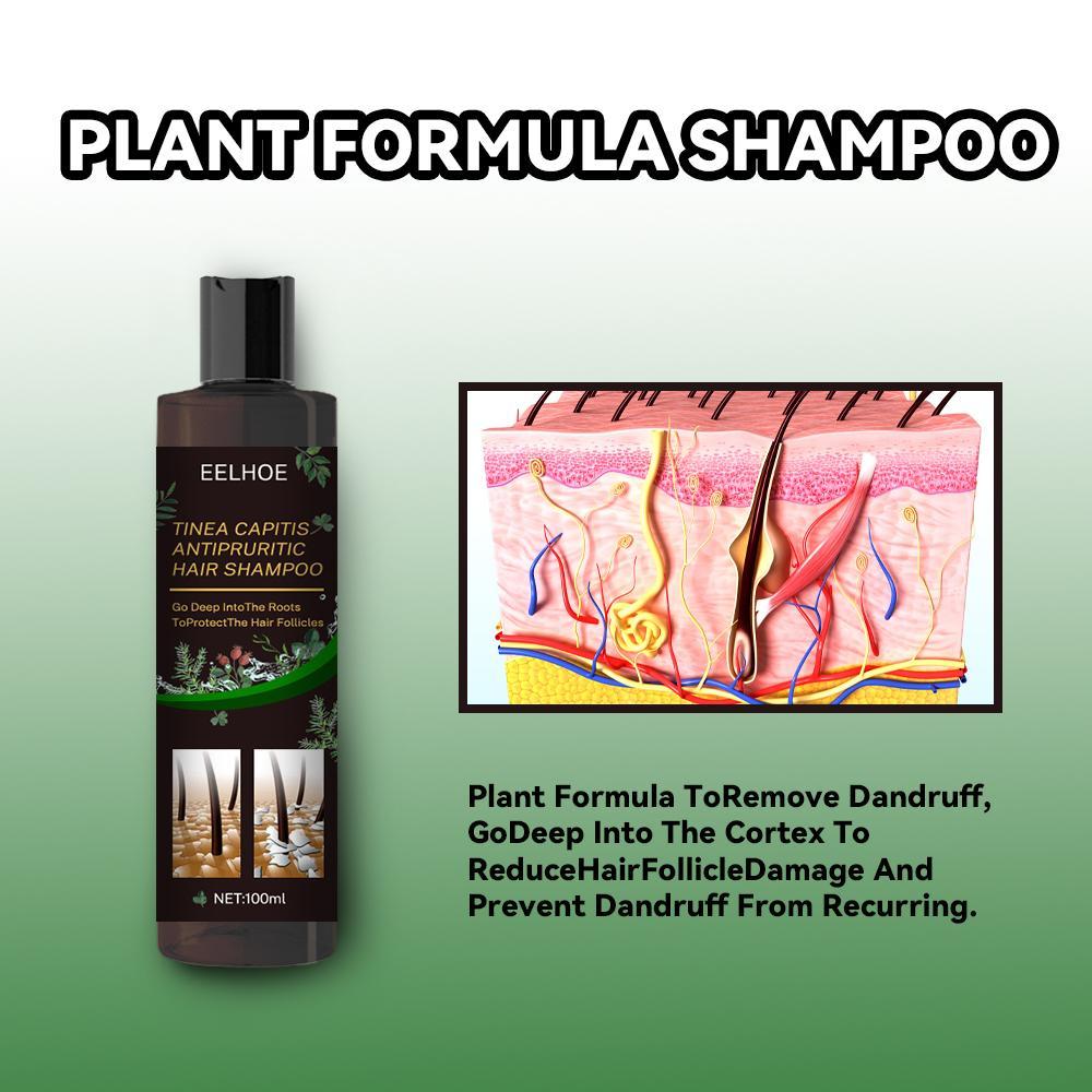 EELHOE Anti-Dandruff Shampoo - Itch Relief, Hair Loss Prevention, Oil Control & Refreshing Care by DC-THE CEO