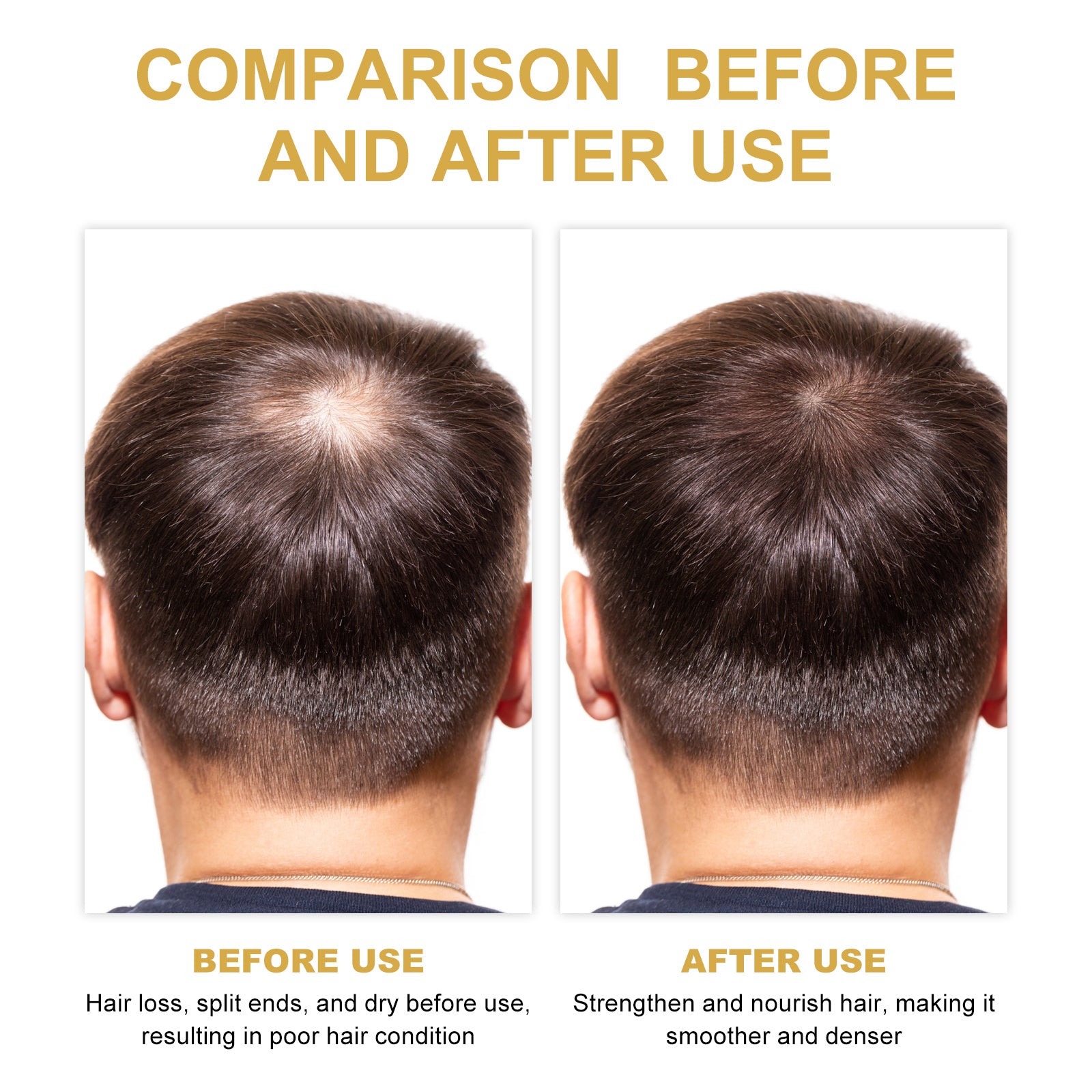 EELHOE Rosemary Hair Treatment Oil Scalp Cleansing Conditioning Volumizing Smoothing Repair Dry Frizzy Hair Conditioning Hair Treatment Oil by DC-THE CEO